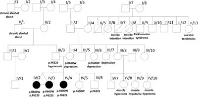 New Insights of Phospholipase A2 Associated Neurodegeneration Phenotype Based on the Long-Term Follow-Up of a Large Hungarian Family